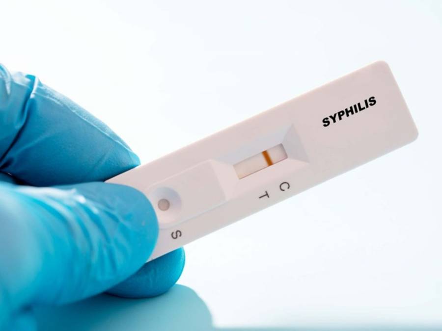 Córdoba enfrenta un aumento alarmante de sífilis entre mujeres embarazadas