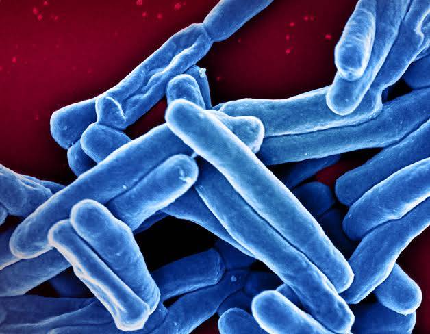 Aumentan los casos de tuberculosis en Antioquia: Alerta por 210 muertes en Medellín